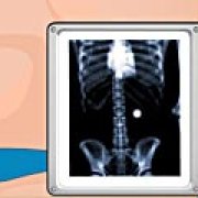 Игра Игра Виртуальная хирургия: операция желудка