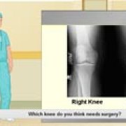 Игра Игра Виртуальная хирургия коленного сустава