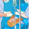Игра Игра Виртуальная Хирургия: операция эпилепсии / Operate Now Epilepsy Surgery